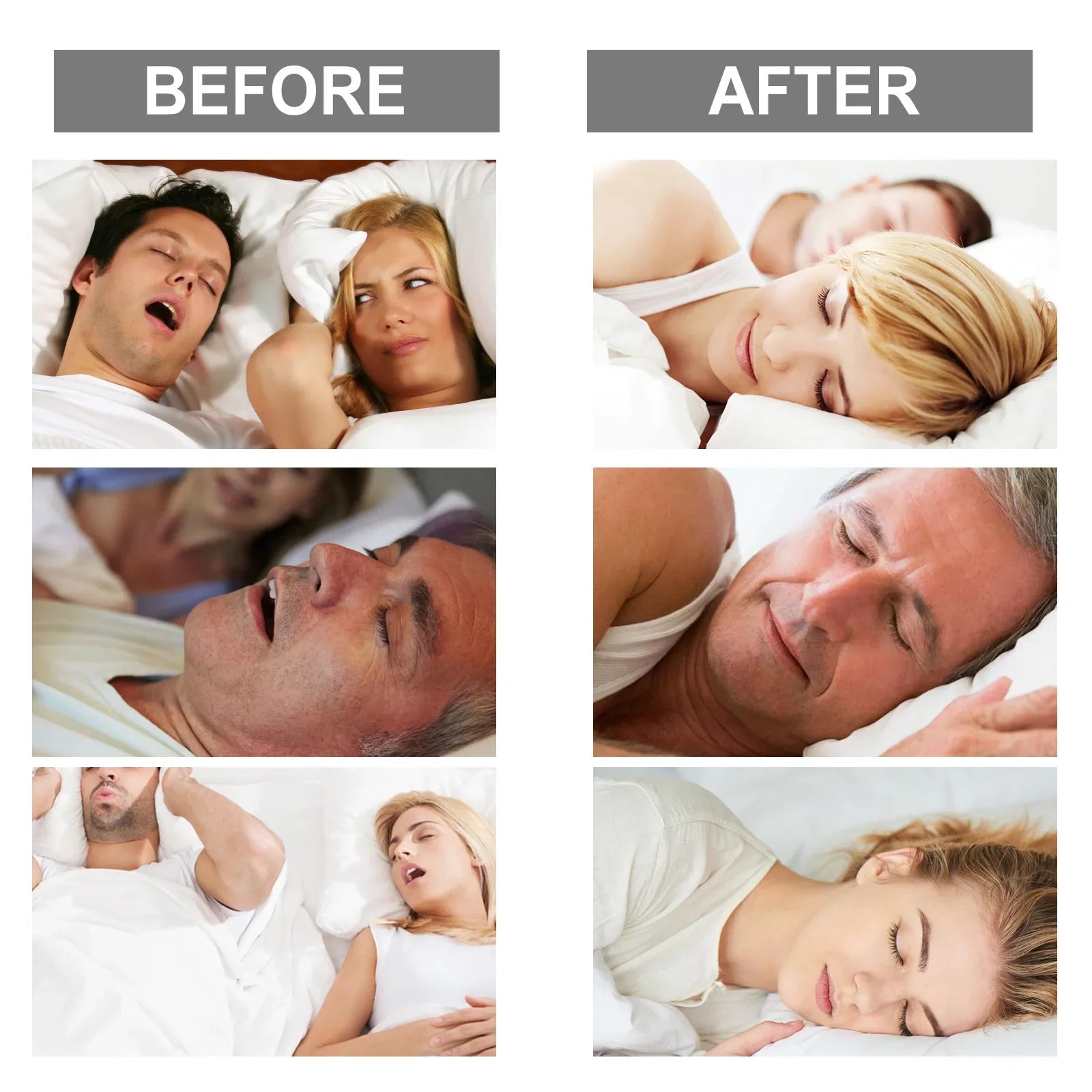 Anti-Snoring Mouth Guard
