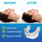 Anti-Snoring Mouth Guard