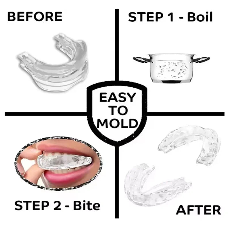 Anti-Snoring Mouth Guard