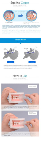 Anti-Snoring Mouth Guard