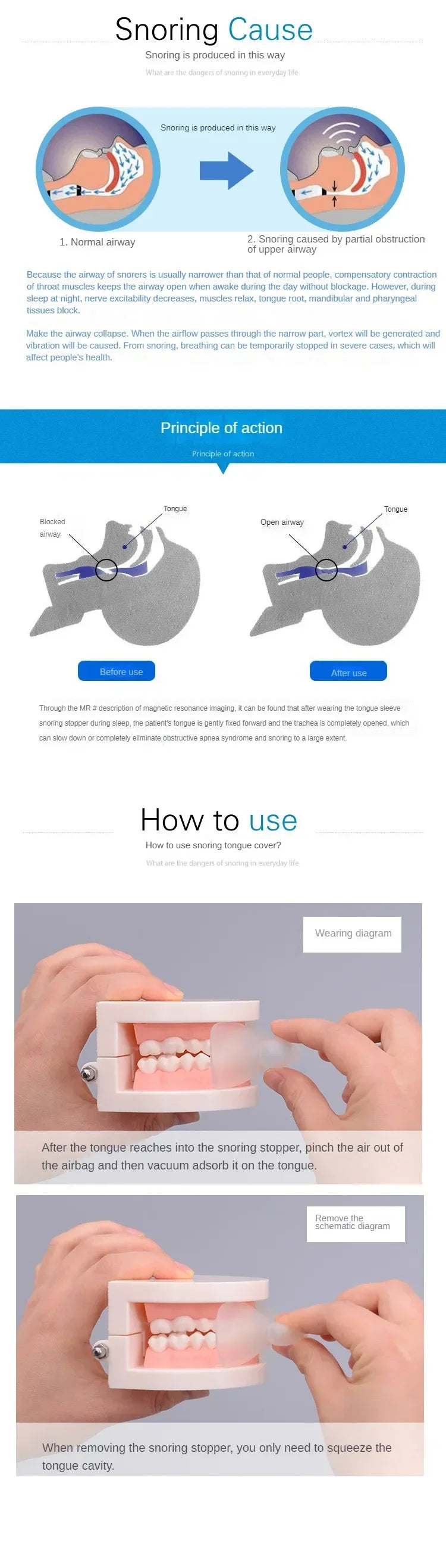 Anti-Snoring Mouth Guard